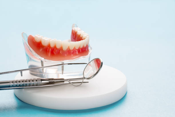 Dental Inlays and Onlays in Kirkland, IL